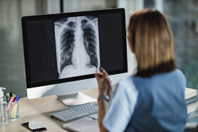 ANGIOTOMOGRAFIA VENOSA DE TÓRAX