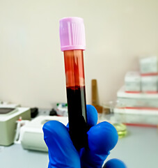 CK - MB - CREATINO FOSFOQUINASE - FRAÇÃO MB 