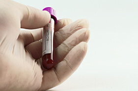 HIV1+ HIV2, (DETERMINAÇÃO CONJUNTA)