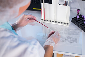 PROTEÍNA C REATIVA (PCR)