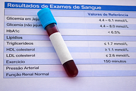 PERFIL LIPÍDICO (Colesterol Total, HDL, LDL, VLDL, Triglicerídeos)