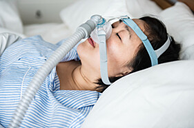 POLISSONOGRAMA COM TESTE DE CPAP NASAL