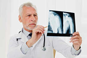 RADIOGRAFIA ARTICULAÇÃO ESTERNOCLAVICULAR