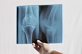 RADIOGRAFIA JOELHO (UNILATERAL)