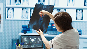 RADIOGRAFIA COLUNA LOMBO-SACRA -3 INCIDÊNCIAS