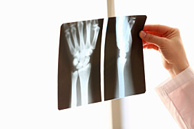 RADIOGRAFIA MÃOS E PUNHOS PARA IDADE ÓSSEA