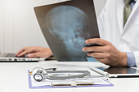 RADIOGRAFIA ORELHA , MASTOIDES OU ROCHEDOS - BILATERAL