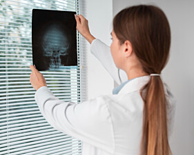 RADIOGRAFIA ÓRBITAS - BILATERAL