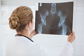 RADIOGRAFIA SACRO-CÓCCIX