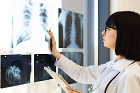 RADIOGRAFIA TÓRAX - 1 INCIDÊNCIA