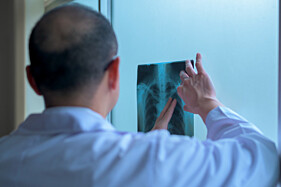 RADIOGRAFIA TÓRAX - 2 INCIDÊNCIAS