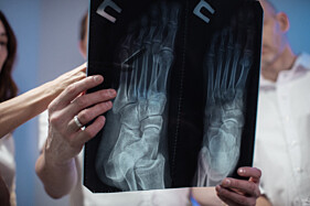 RESSONÂNCIA MAGNÉTICA PÉ, ANTEPÉ- NÃO INCLUI TORNOZELO