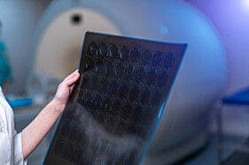 RESSONÂNCIA MAGNÉTICA ABDOME SUPERIOR 