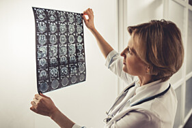 RESSONÂNCIA MAGNÉTICA BASE DO CRÂNIO