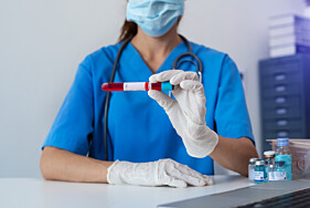TESTOSTERONA LIVRE 