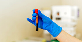 TIREOESTIMULANTE, HORMONIO (TSH) 