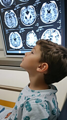 ULTRASSONOGRAFIA - CRÂNIO PARA CRIANÇA