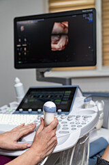 ULTRASSONOGRAFIA DOPPLER COLORIDO ARTERIAL DE MEMBRO INFERIOR - UNILATERAL